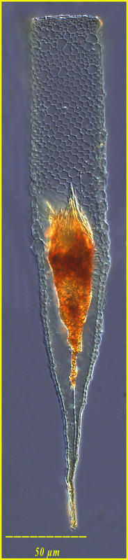 Image of Xystonella lohmanni (Brandt) Kofoid & Campbell 1929