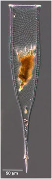 Image of Xystonella treforti (Daday 1887)