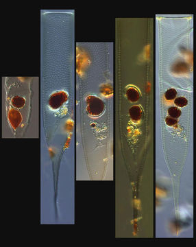 Image of Xystonella lohmanni (Brandt) Kofoid & Campbell 1929