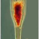 Imagem de Xystonellopsis dicymatica (Brandt 1906) Kofoid & Campbell 1929