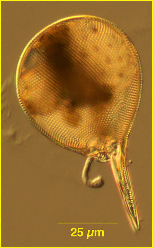 Image de Protocystis xiphodon