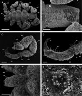 Image de Pycnogonum (Retroviger) pusillum Dohrn 1881