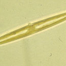 Image of Amphipleura pellucida