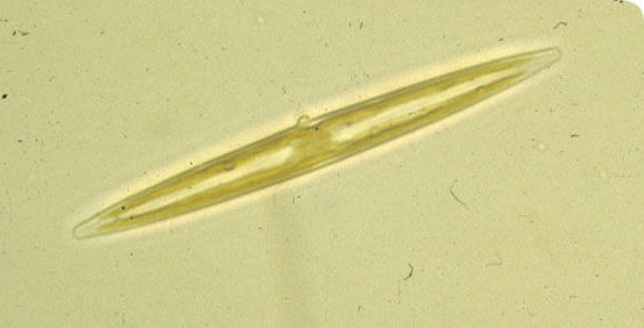 Image of Amphipleura pellucida