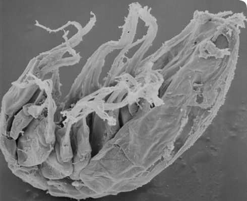 صورة Microdajus pectinatus Boxshall, Huys & Lincoln 1988