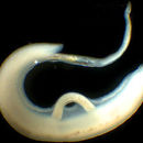 Image de Schistosoma