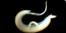 Image of <i>Schistosoma mansoni</i>