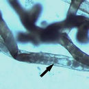 Image of <i>Tetracapsuloides bryosalmonae</i>
