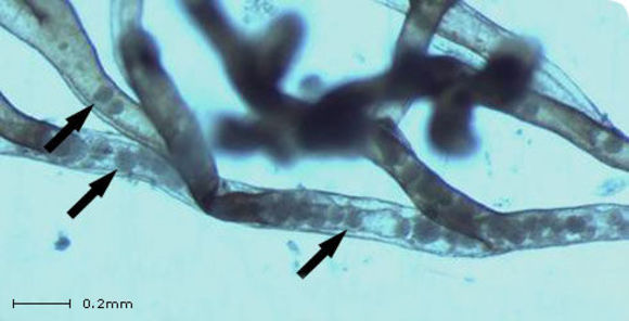 Image of <i>Tetracapsuloides bryosalmonae</i>