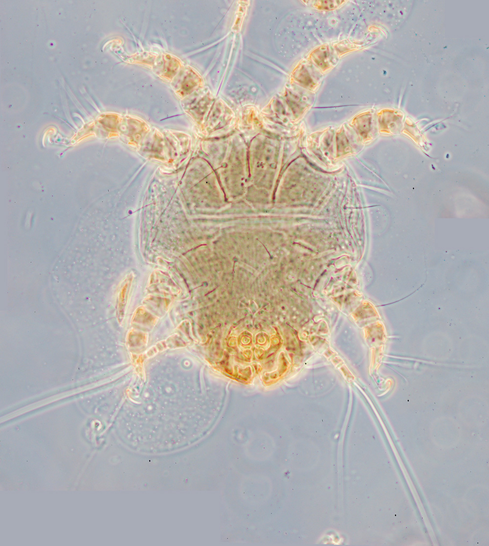 Image of <i><i>Chaetodactylus</i></i> (Chaetodactylus) <i>birulai</i>