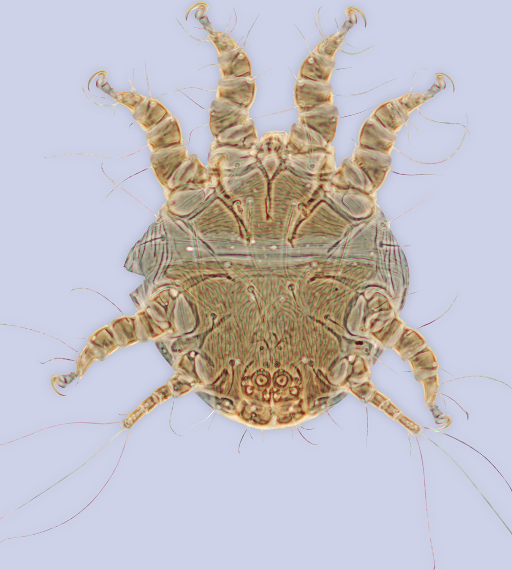 Chaetodactylus resmi