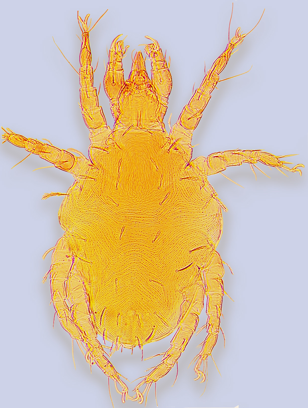 Image of Cheyletidae