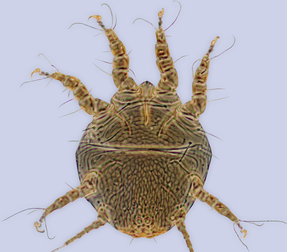 Image of <i>Chaetodactylus</i> (<i>Achaetodactylus</i>) <i>dementjevi</i>