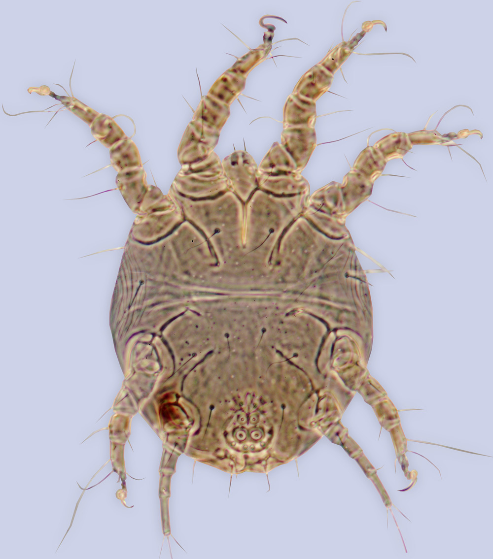 Image of <i>Chaetodactylus furunculus</i>