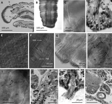 Image of <i>Cookidrilus pocosinus</i> Rodriguez, Fend & Lenat 2014