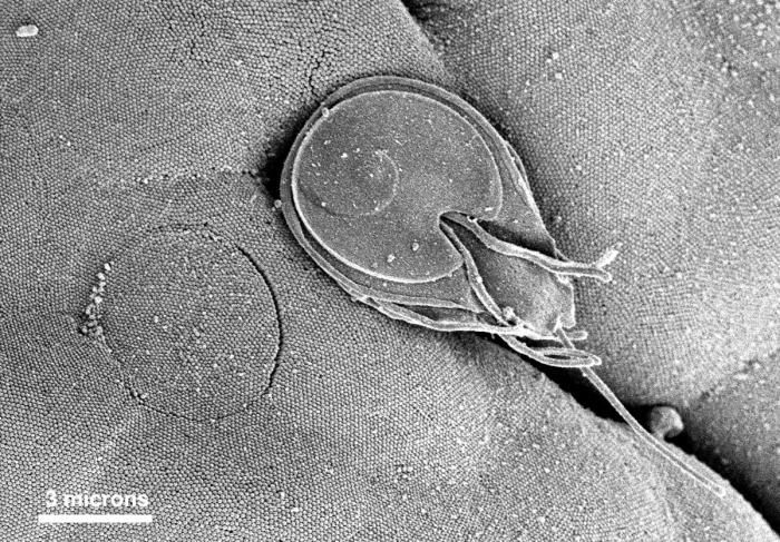 Image of Giardia