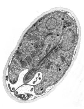 Image of Giardia