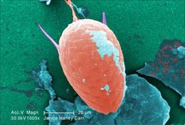 Image of Giardia