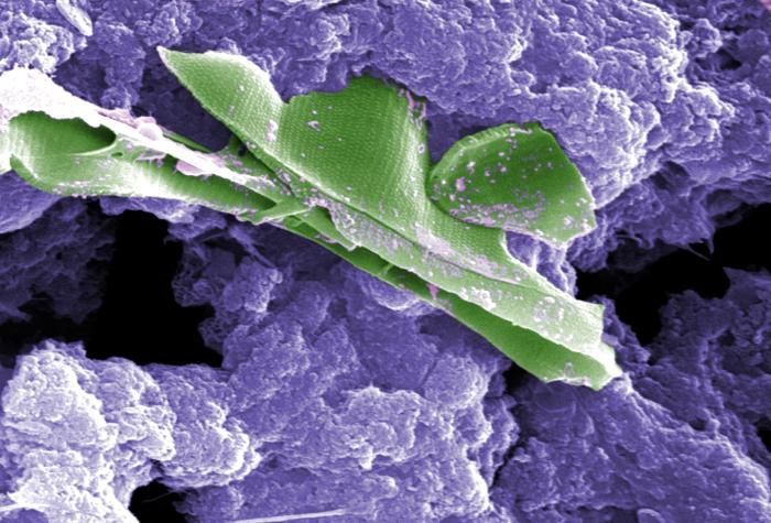 Image of Giardia