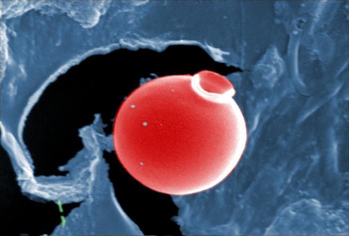 Image of Giardia