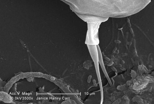 Image of Giardia