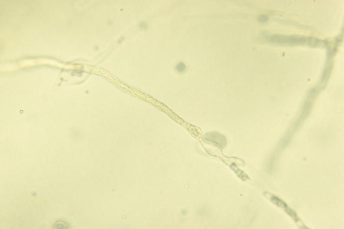Image of Fissuricella filamenta (P. Arnold & Ahearn) Pore, D' Amatao & Ajello 1977