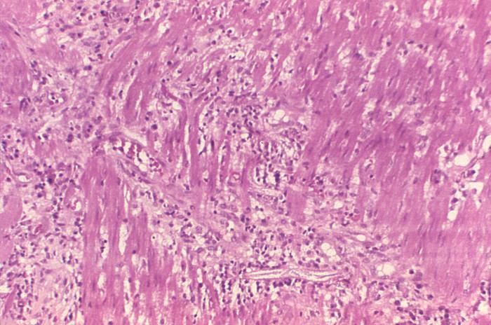 Слика од Strongyloides