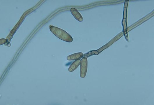 Image of Curvularia harveyi Shipton 1966