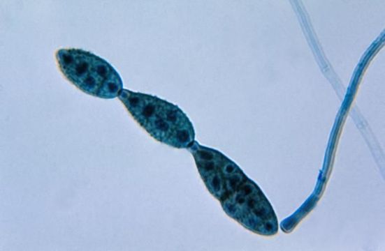 Image of Pleosporaceae