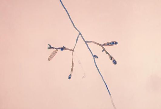 Image of Exserohilum rostratum (Drechsler) K. J. Leonard & Suggs 1974