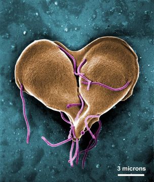 Plancia ëd Giardia