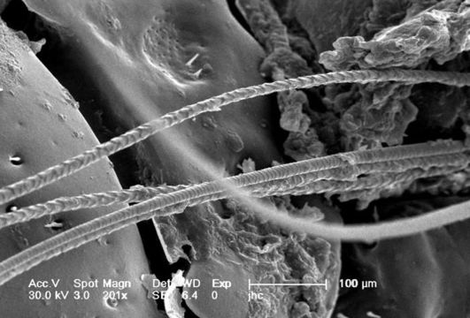 Image de Borrelia