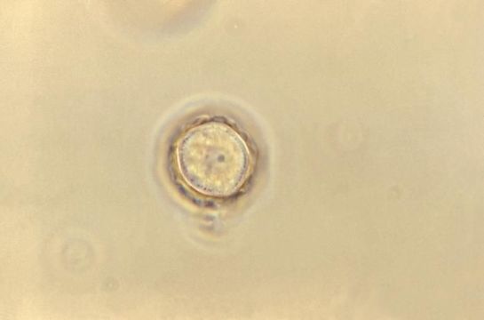 Image of Acanthamoeba polyphaga