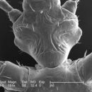 Image of human body louse