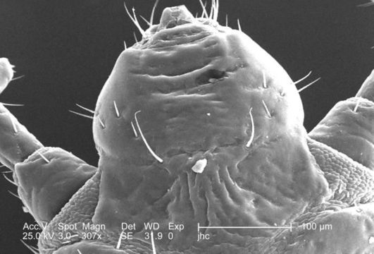 Image of human body louse