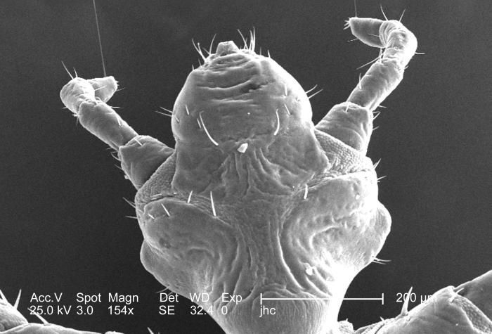 Image of human body louse