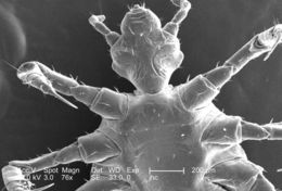 Image of human body louse