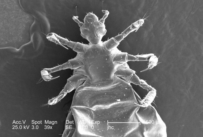 Image of human body louse