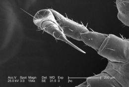 Image of human body louse