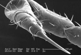 Image of human body louse