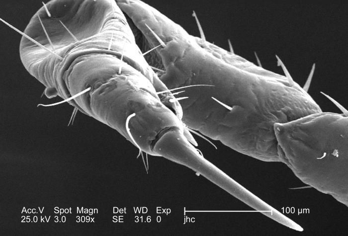 Image of human body louse