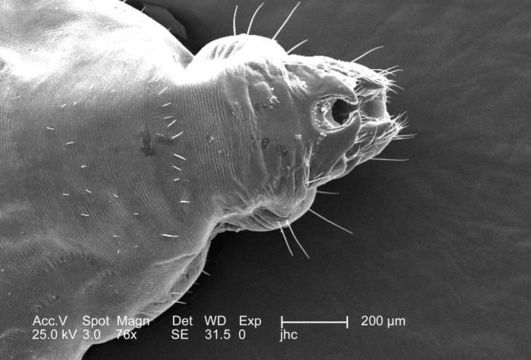 Image of human body louse