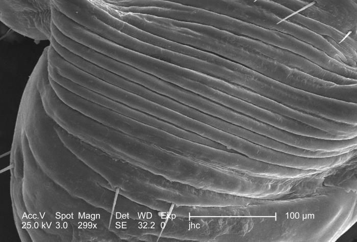 Image of human body louse