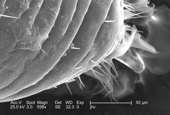 Image of human body louse