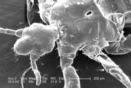 Image of human body louse