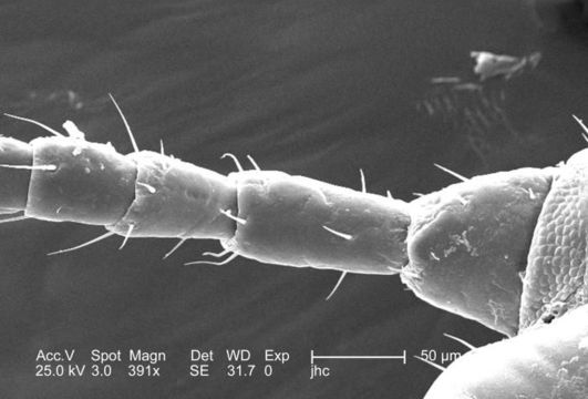 Image of human body louse