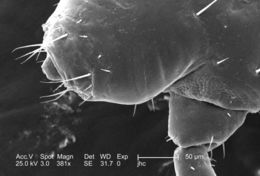 Image of human body louse