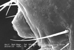 Image of human body louse