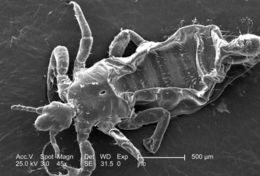 Image of human body louse