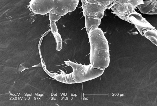 Image of human body louse